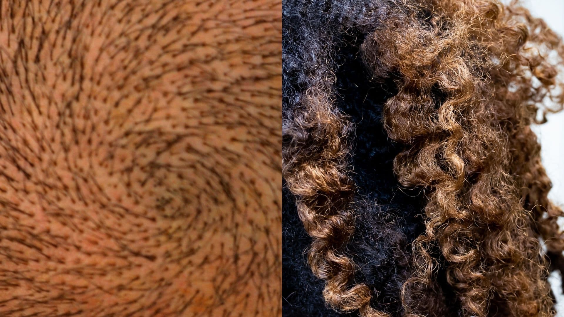 Hair Growth vs Retention!